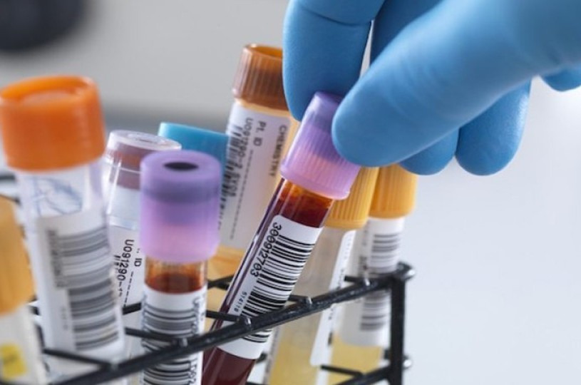 Exames bioquímicos no laboratório estão suspensos temporariamente