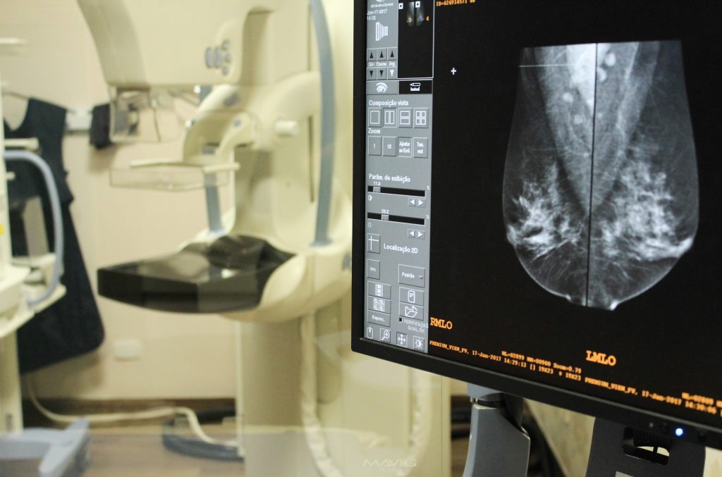 A mamografia é uma espécie de raios X das mamas, importante para o diagnóstico precoce do câncer de mama. Foto: Divulgação