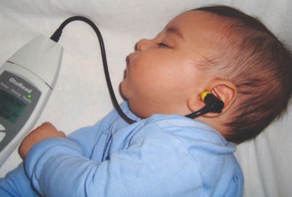 O exame é feito enquanto o bebê está dormindo, sem dor. Foto: Divulgação