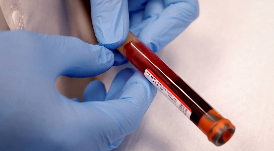 Saiba passo a passo para fazer exame de coronavírus pelo plano de saúde Saiba passo a passo para fazer exame de coronavírus pelo plano de saúde